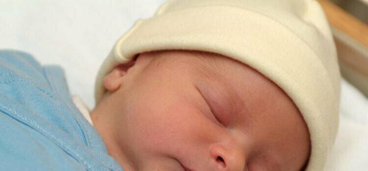 What To Do If Your Newborn Has Jaundice? What To Do If Your Newborn Has Jaundice?