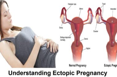 Comprehending Ectopic Pregnancy